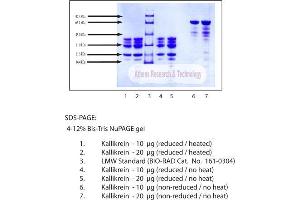 Gel Scan of Kallikrein, Human Plasma  This information is representative of the product ART prepares, but is not lot specific.