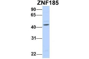 Host:  Rabbit  Target Name:  ZNF185  Sample Type:  Human Fetal Brain  Antibody Dilution:  1. (Zinc Finger Protein 185 anticorps  (N-Term))