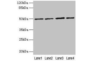 Western blot All lanes: EVA1C antibody at 5 μg/mL Lane 1: Hela whole cell lysate Lane 2: Jurkat whole cell lysate Lane 3: 293T whole cell lysate Lane 4: HL60 whole cell lysate Secondary Goat polyclonal to rabbit IgG at 1/10000 dilution Predicted band size: 50, 8 kDa Observed band size: 50 kDa (EVA1C anticorps  (AA 49-322))