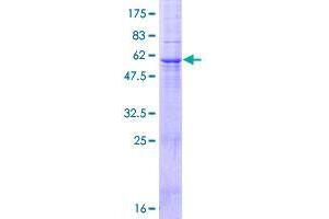 Image no. 1 for F-Box Protein 27 (FBXO27) (AA 1-283) protein (GST tag) (ABIN1353786)