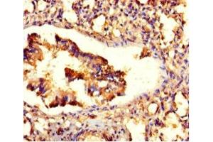 Immunohistochemistry of paraffin-embedded human lung tissue using ABIN7176521 at dilution of 1:100 (ZNF77 anticorps  (AA 1-300))