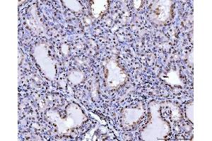IHC analysis of PC4/SUB1 using anti-PC4/SUB1 antibody (ABIN7602184).