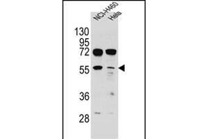 TSPYL6 Antibody (Center) (ABIN655239 and ABIN2844842) western blot analysis in NCI-,Hela cell line lysates (35 μg/lane). (TSPY-Like 6 anticorps  (AA 206-235))