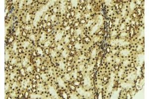 ABIN6277795 at 1/100 staining Mouse kidney tissue by IHC-P. (PRKACB anticorps  (pThr197))