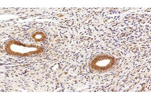 Detection of HMGB1 in Rat Uterus Tissue using Polyclonal Antibody to High Mobility Group Protein 1 (HMGB1) (HMGB1 anticorps  (AA 1-215))