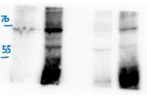 anti-Serine Incorporator 5 (SERINC5) (AA 64-394) antibody