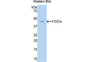 Western blot analysis of the recombinant protein. (Oxytocin Receptor anticorps  (AA 272-377))