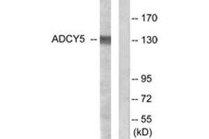 Western blot analysis of extracts from COLO205 cells, using ADCY5/6 Antibody. (ADCY5/6 anticorps  (AA 931-980))