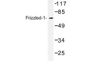 Image no. 1 for anti-Frizzled Family Receptor 1 (Fzd1) antibody (ABIN317638) (FZD1 anticorps)