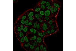 Immunofluorescence staining of MCF-7 cells using MSH6 Mouse Monoclonal Antibody (MSH6/3091) followed by goat anti-Mouse IgG conjugated to CF488 (green). (MSH6 anticorps  (AA 374-540))