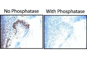EGF Receptor (pY845) staining on tonsil. (EGFR anticorps  (pTyr845))