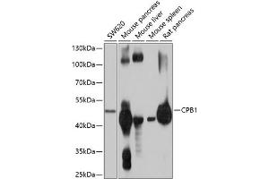 Western blot analysis of extracts of various cell lines, using CPB1 antibody (ABIN6131301, ABIN6138934, ABIN6138935 and ABIN6214759) at 1:1000 dilution.
