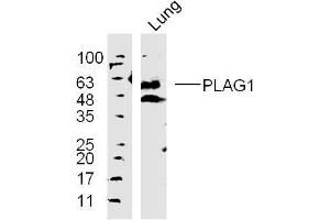 Lane 1: mouse lung lysates probed with 	PLAG1 Polyclonal Antibody, Unconjugated  at 1:300 overnight at 4˚C. (PLAG1 anticorps  (AA 51-150))
