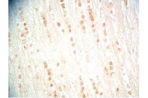 Rat brain tissue was stained by Rabbit Anti-RAR-related Orphan Receptor A isoform a (29-523) Serum