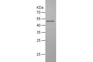 Western Blotting (WB) image for Superoxide Dismutase 3, Extracellular (SOD3) (AA 19-240) protein (His-IF2DI Tag) (ABIN7125250)