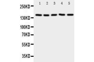 Western Blotting (WB) image for anti-Replication Factor C (Activator 1) 1, 145kDa (RFC1) (AA 46-64), (N-Term) antibody (ABIN3043075) (RFC1 anticorps  (N-Term))