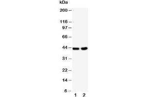 Western blot testing of BCAT1 antibody and Lane 1:  HeLa;  2: Jurkat cell lysate (BCAT1 anticorps  (C-Term))