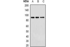 Western blot analysis of Cullin 4A expression in Hela (A), HepG2 (B), mouse brain (C) whole cell lysates. (Cullin 4A anticorps)