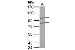 Image no. 1 for anti-CTD (Carboxy-terminal Domain, RNA Polymerase II, Polypeptide A) Phosphatase, Subunit 1 (CTDP1) (N-Term) antibody (ABIN1494011) (CTDP1 anticorps  (N-Term))