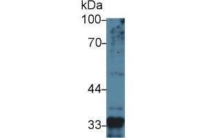 Detection of MSTN in Human Liver lysate using Monoclonal Antibody to Myostatin (MSTN)