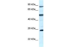 WB Suggested Anti-AK7 Antibody Titration: 1. (Adenylate Kinase 7 anticorps  (C-Term))