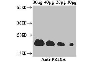 Western Blot Positive WB detected in: Coptis japonica (80 μg, 40 μg, 20 μg, 10 μg) All lanes: PR10A antibody at 3. (PR1a Precursor anticorps  (AA 20-196))