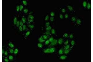 Immunofluorescent analysis of HepG2 cells using ABIN7155856 at dilution of 1:100 and Alexa Fluor 488-congugated AffiniPure Goat Anti-Rabbit IgG(H+L) (TGIF2 anticorps  (AA 82-222))