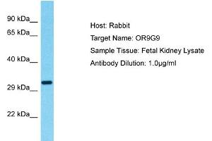 Host: Rabbit Target Name: OR9G9 Sample Type: Fetal Kidney lysates Antibody Dilution: 1. (OR9G9 anticorps  (C-Term))