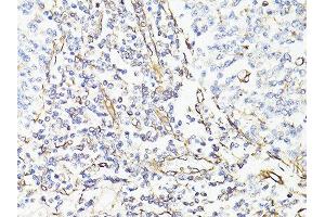 Immunohistochemistry of paraffin-embedded human tonsil using VIM antibody.