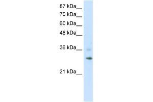 WB Suggested Anti-RNF113B Antibody Titration:  1. (RNF113B anticorps  (C-Term))