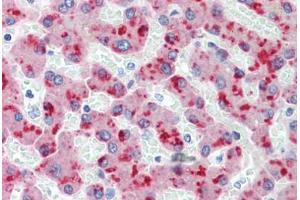 Human Liver (formalin-fixed, paraffin-embedded) stained with CFH antibody ABIN462334 followed by biotinylated anti-mouse IgG secondary antibody ABIN481714, alkaline phosphatase-streptavidin and chromogen. (Complement Factor H anticorps)