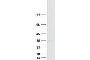 Validation with Western Blot