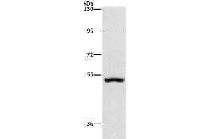 Western Blot analysis of Mouse kidney tissue using SYT17 Polyclonal Antibody at dilution of 1:650 (SYT17 anticorps)