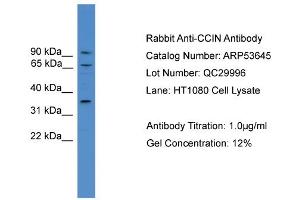 WB Suggested Anti-CCIN  Antibody Titration: 0. (Calicin anticorps  (N-Term))