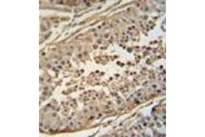 Immunohistochemistry analysis in formalin fixed and paraffin embedded human testis tissue reacted with FBXO24 Antibody  followed by peroxidase conjugation of the secondary antibody and DAB staining. (FBXO24 anticorps  (Middle Region))