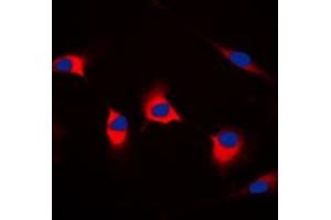 Immunofluorescent analysis of CDKL4 staining in MCF7 cells. (CDKL4 anticorps  (C-Term))