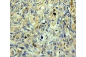 Used in DAB staining on fromalin fixed paraffin-embedded Ovary tissue (GSTM3 anticorps  (AA 8-223))