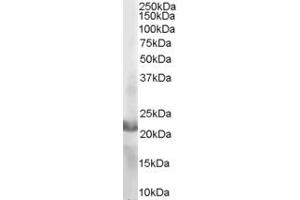 ABIN184689 staining (2µg/ml) of MOLT-4 lysate (RIPA buffer, 35µg total protein per lane). (RAC2 anticorps  (C-Term))