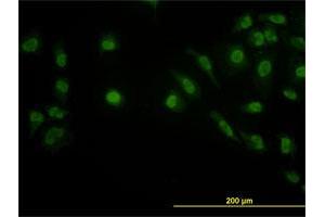 Immunofluorescence of monoclonal antibody to LDB2 on HeLa cell.