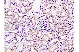 Formalin-fixed and paraffin embedded mouse kidney tissue labeled with Anti-Cathepsin H Polyclonal Antibody, Unconjugated (ABIN732758) at 1:200 followed by conjugation to the secondary antibody, (SP-0023), and DAB staining