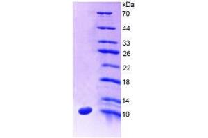 SDS-PAGE analysis of Human SLC30A8 Protein. (SLC30A8 Protéine)