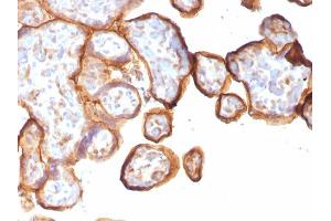Formalin-fixed, paraffin-embedded human Placenta stained with Thrombomodulin / CD141 Monoclonal Antibody (rTHBD/1591).