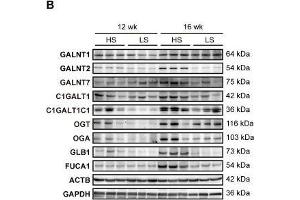 Upregulation of glycogene expression in the LV of DS hypertensive rats. (GLB1 anticorps)