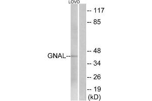 Western Blotting (WB) image for anti-Guanine Nucleotide Binding Protein, alpha Stimulating, Olfactory Type (GNAL) (Internal Region) antibody (ABIN1851420) (GNAL anticorps  (Internal Region))