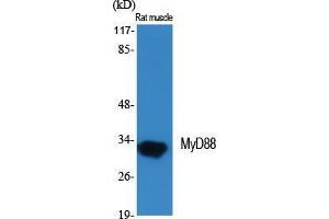 Western Blot (WB) analysis of specific cells using MyD88 Polyclonal Antibody. (MYD88 anticorps  (Internal Region))