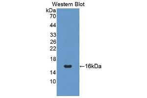 Western blot analysis of the recombinant protein. (PIGR anticorps  (AA 135-237))