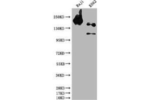 Western Blot Positive WB detected in: Raji whole cell lysate, K562 whole cell lysate All lanes: INPP5D antibody at 1:1500 Secondary Goat polyclonal to rabbit IgG at 1/50000 dilution Predicted band size: 134, 110 kDa Observed band size: 145 kDa
