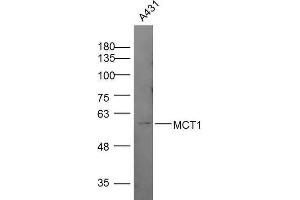 Lane 1: A431 lysates, probed with MCT1 Polyclonal Antibody, Unconjugated  at 1:300 overnight at 4˚C.