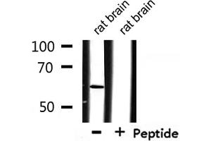 Western blot analysis of extracts from rat brain, using CSTF2 Antibody. (CSTF2 anticorps  (N-Term))