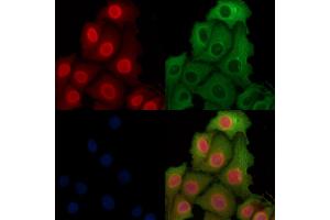 ABIN6262398 and ABIN6269012 staining Hela cells by IF/ICC. (HSP70 1A anticorps  (C-Term))